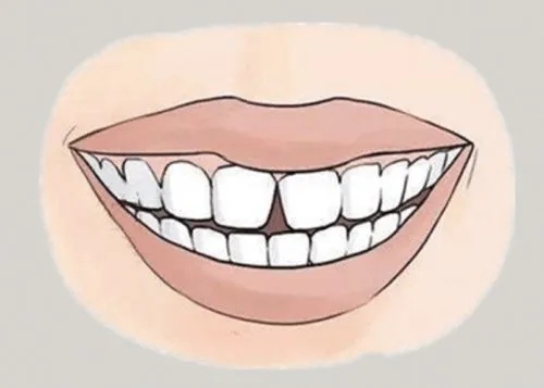 <a href=http://m.lzsina.cn/news_article?news_id=116>一次性口腔探針</a>